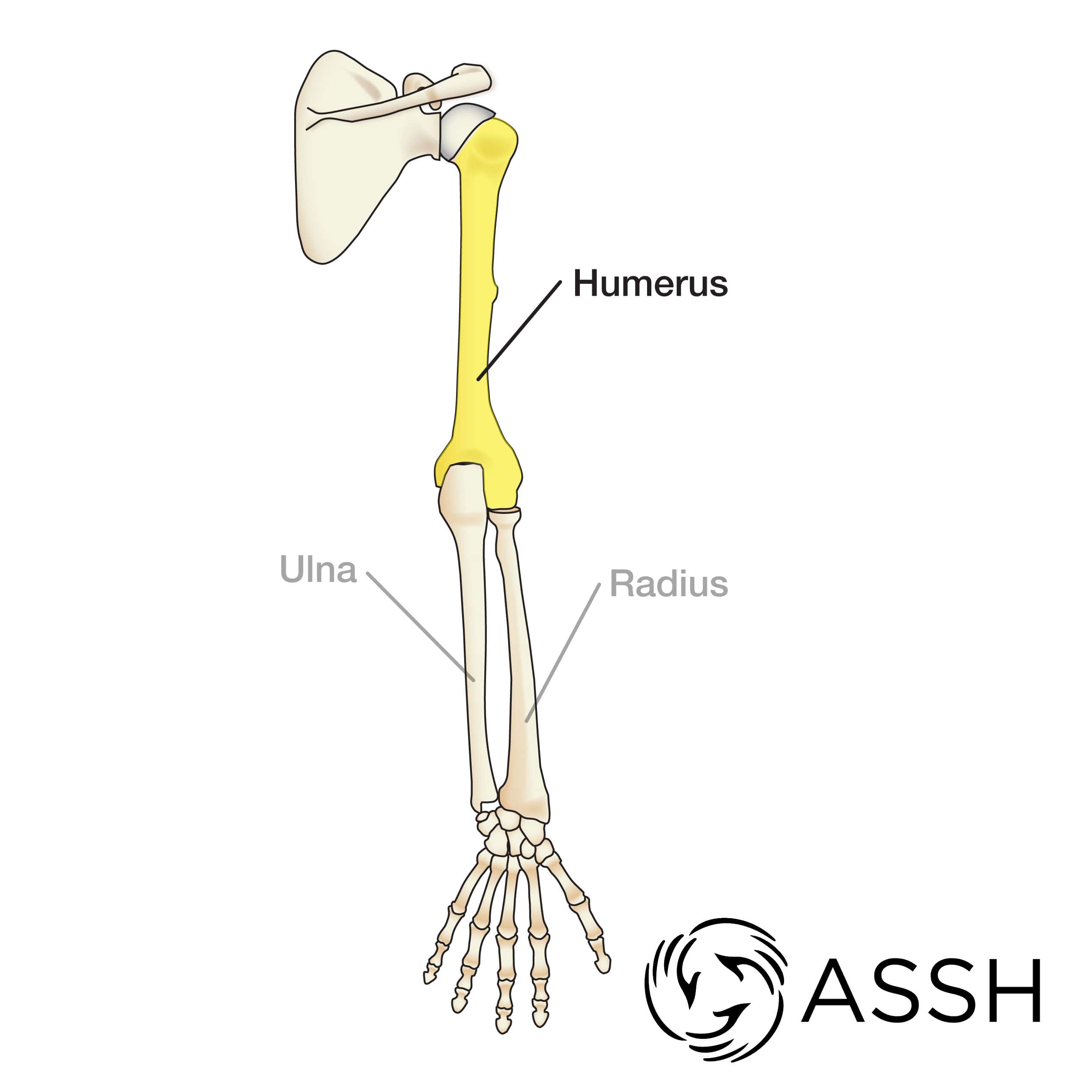 3: Partial frontal cutting of a typical long human bone. Humerus