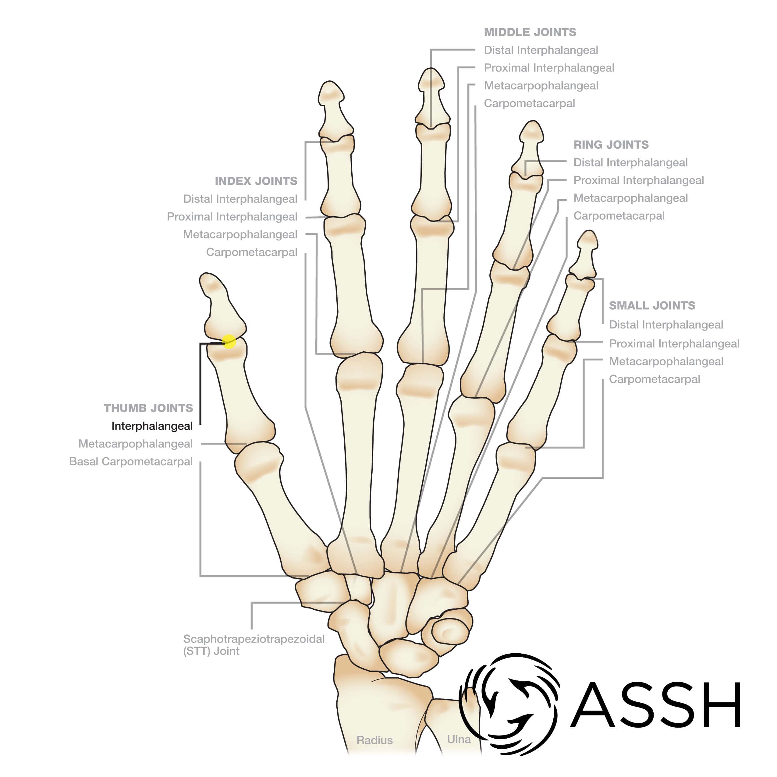 Body Anatomy Upper Extremity Joints The Hand Society