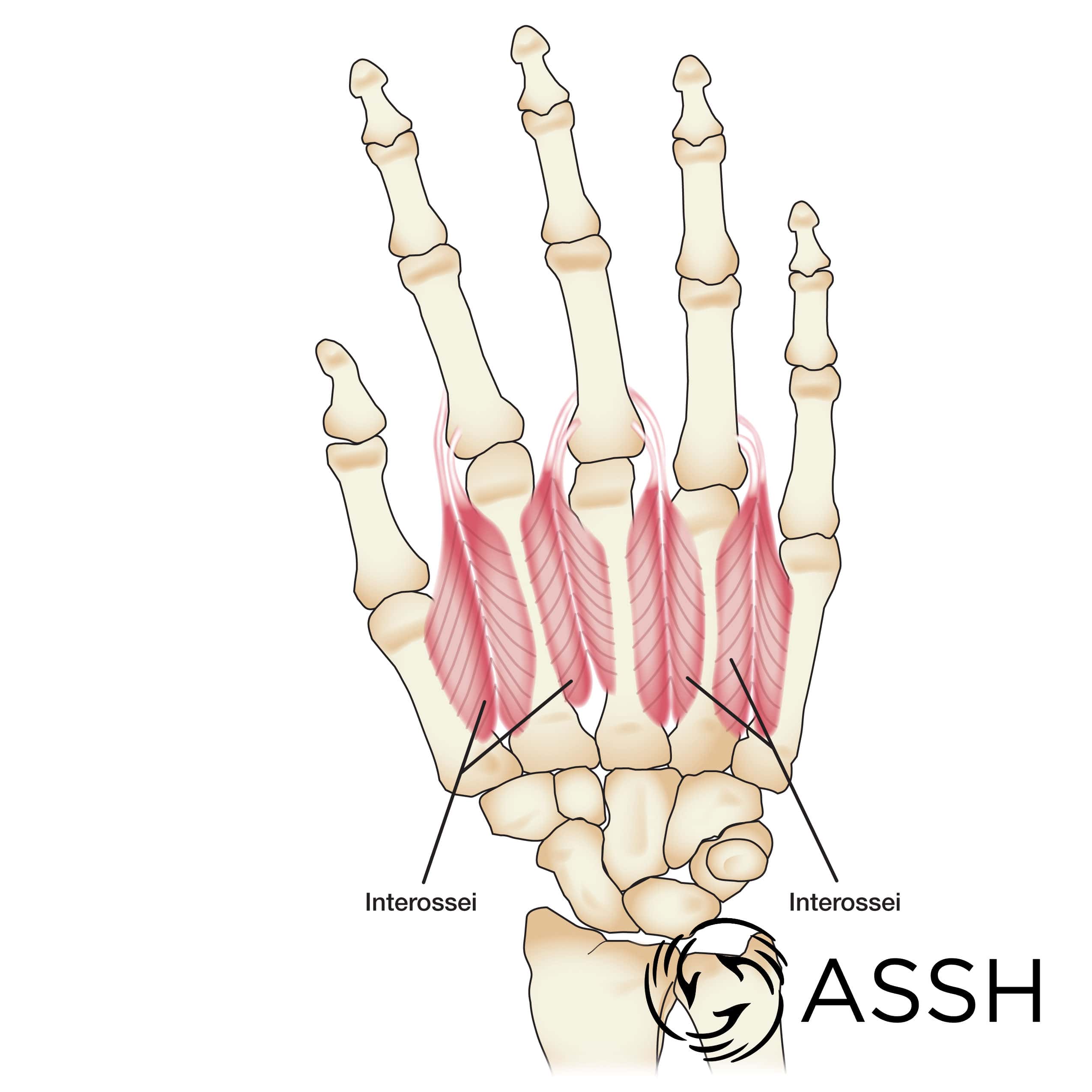 What does it mean if there is a deep surface in between both palms