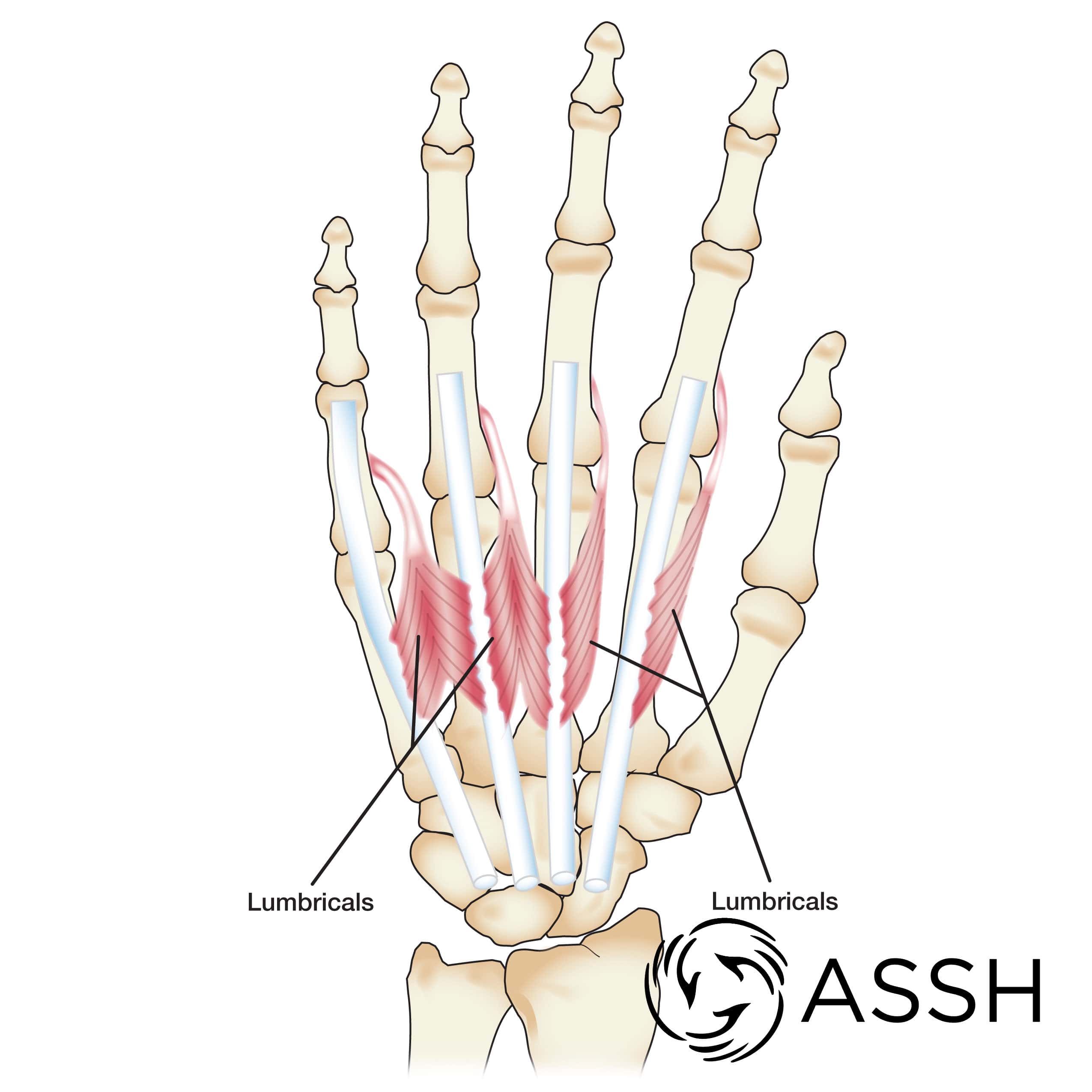 Body Anatomy: Upper Extremity Muscles