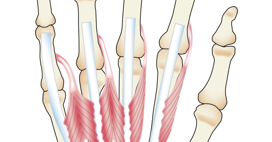 Know your body: If there are no muscles in the fingers, how do they move?