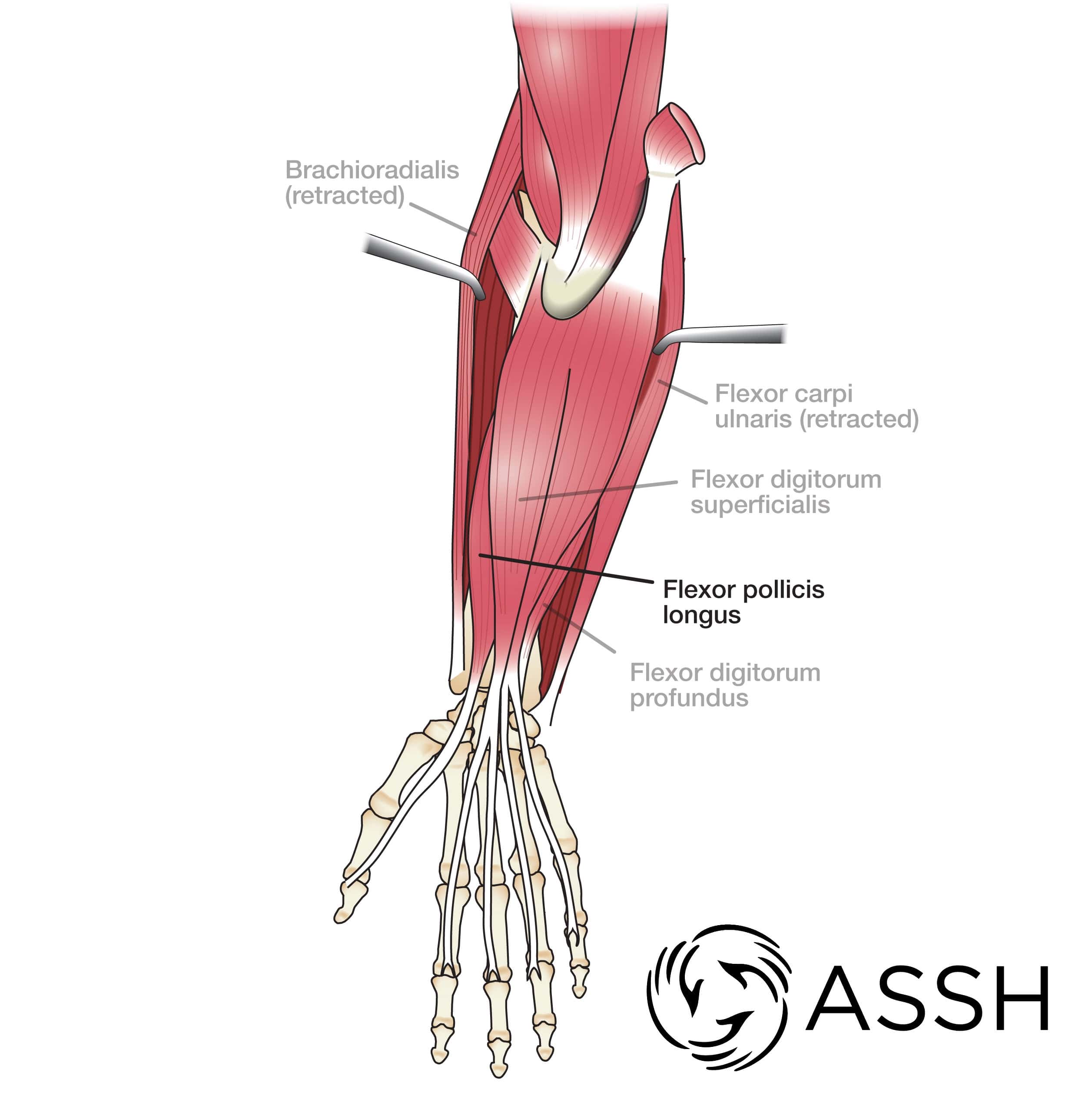 Body Anatomy Upper Extremity Muscles The Hand Society