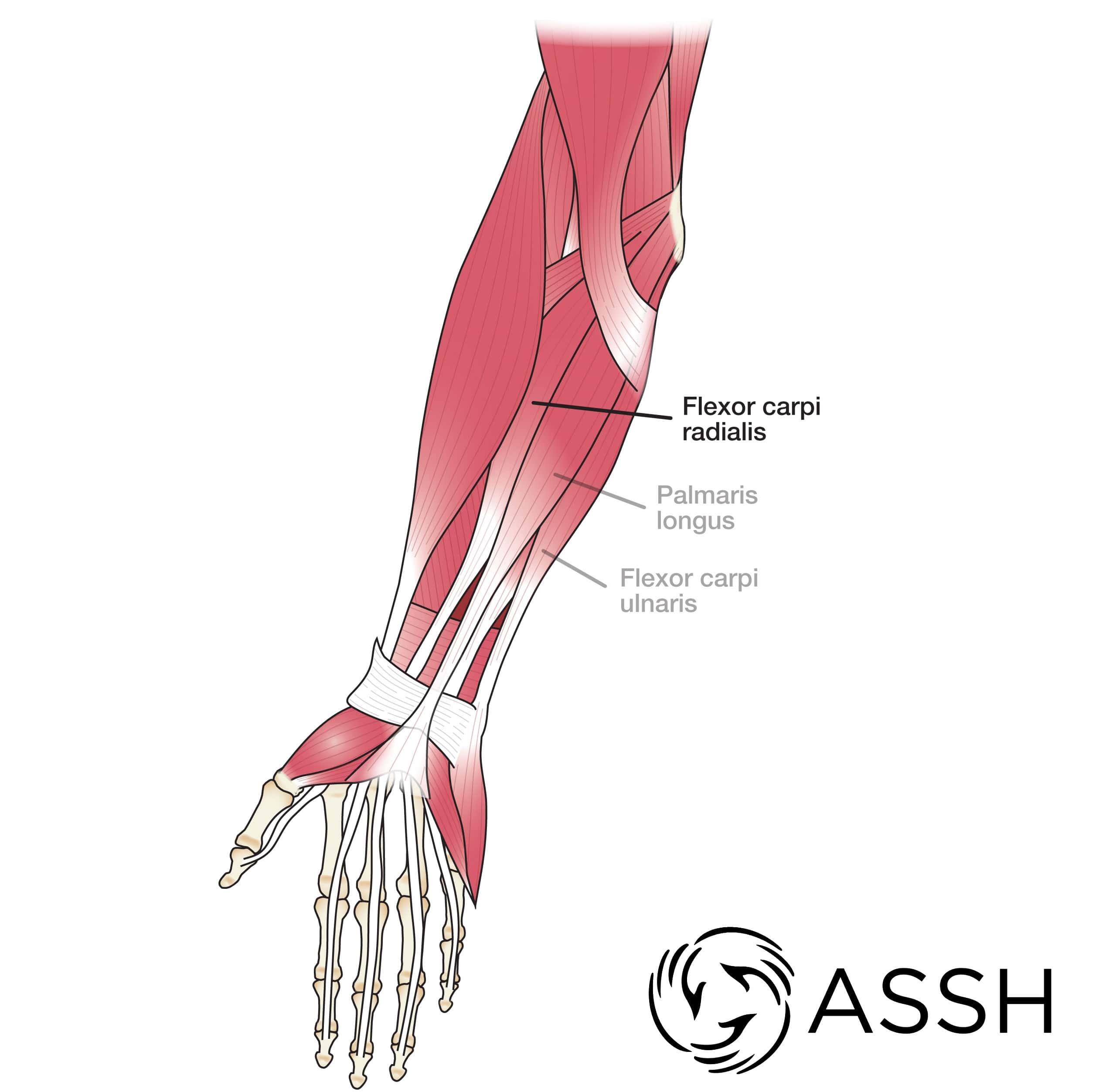 forearm tendon