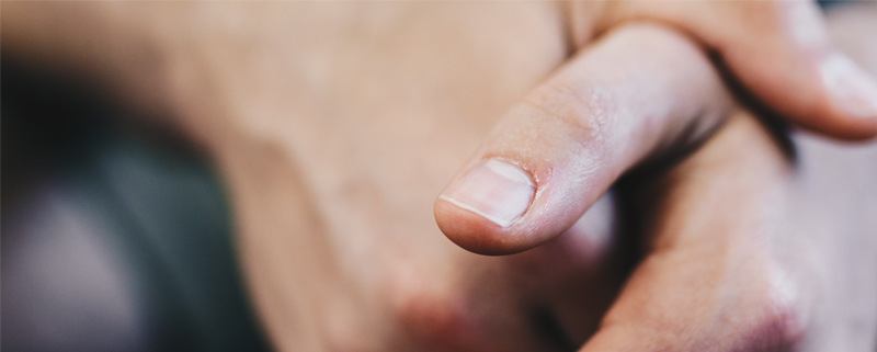 How to Get Rid of a Hangnail