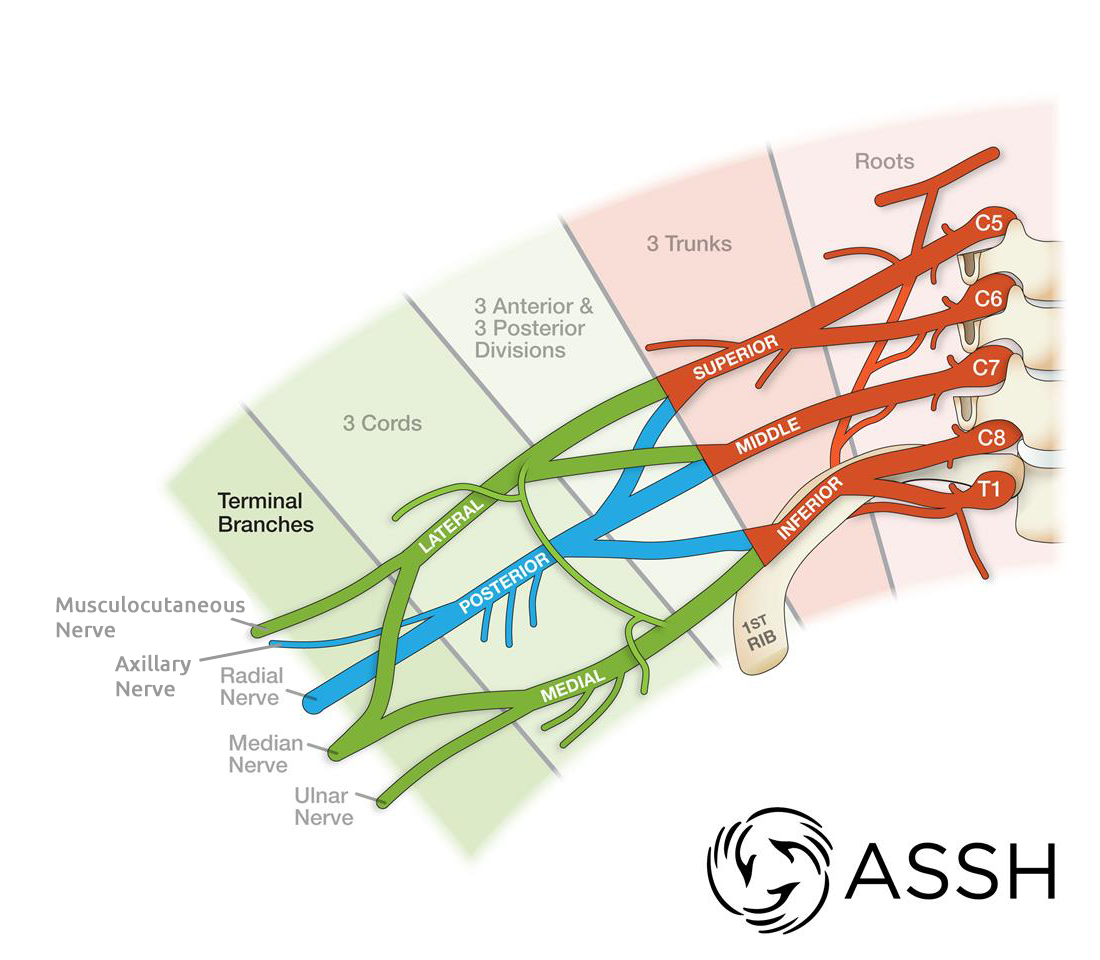 brachial plexus anatomy model