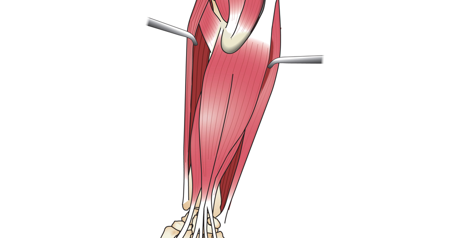 Body Anatomy: Upper Extremity Tendons | The Hand Society