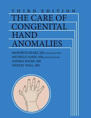 Care of Congenital Hand Anomalies | Store | ASSH